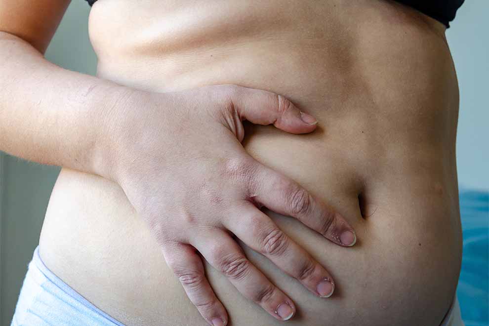 Pessoa segurando a barriga com uma mão.