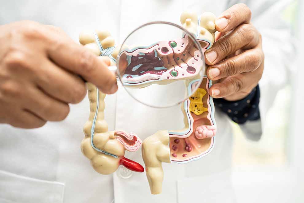 e7e4b7708286a9e060a7edc846306664_microbiotaintestinal.jpg